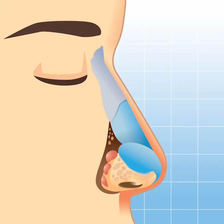 cartilagos de la nariz