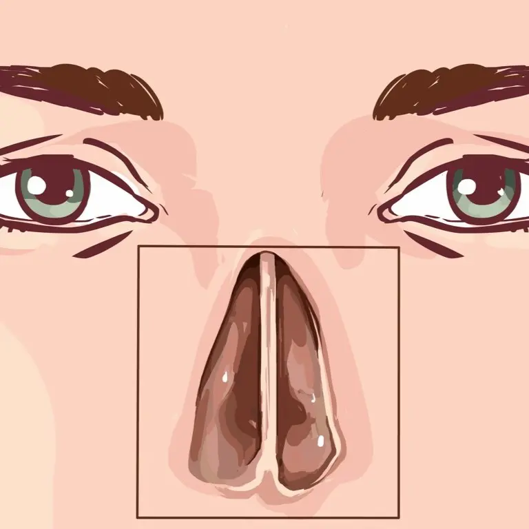 tabique nasal normal